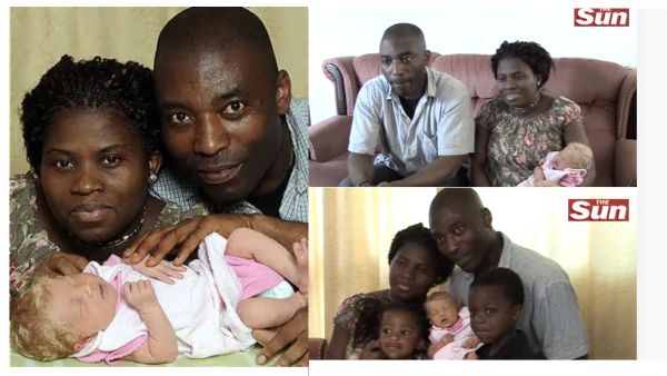 Nigerian couple gives birth to white baby